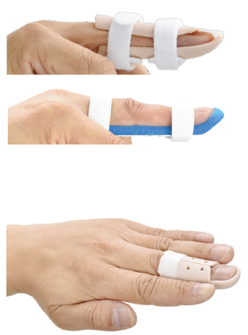 Other injury splints vertical